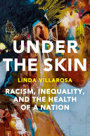 Under the Skin